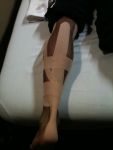 Kinesiotaping for calf/Achilles strain.